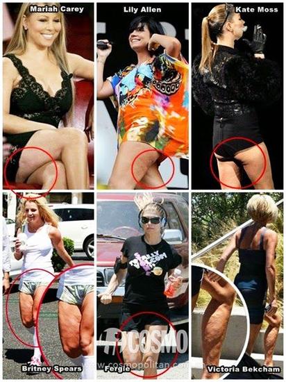 明星腿上的“小酒窩”