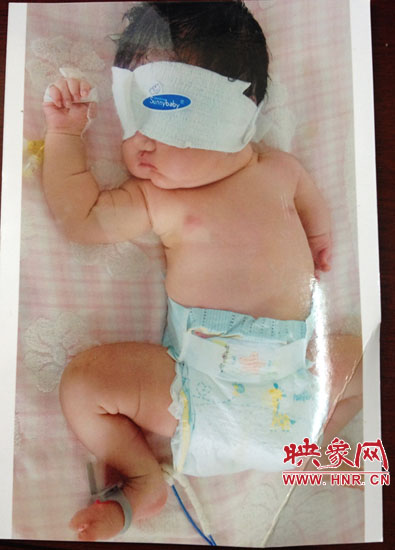 胎兒醫(yī)院四維彩超顯示一切正常 出生后肢體殘缺 胎兒醫(yī)院四維彩超顯示一切正常 出生后肢體殘缺