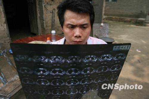 河南"開胸驗(yàn)肺者"低保被取消 河南"開胸驗(yàn)肺者"低保被取消