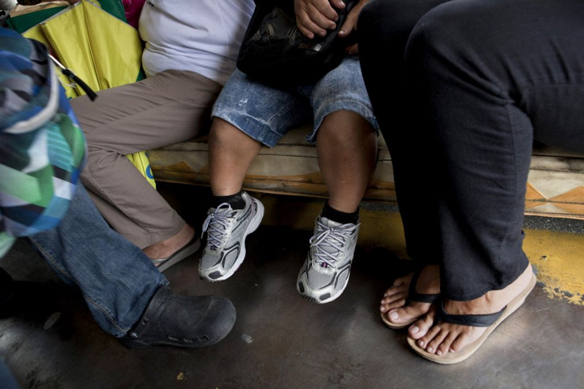 侏儒癥患者的艱辛生活 侏儒癥患者的艱辛生活