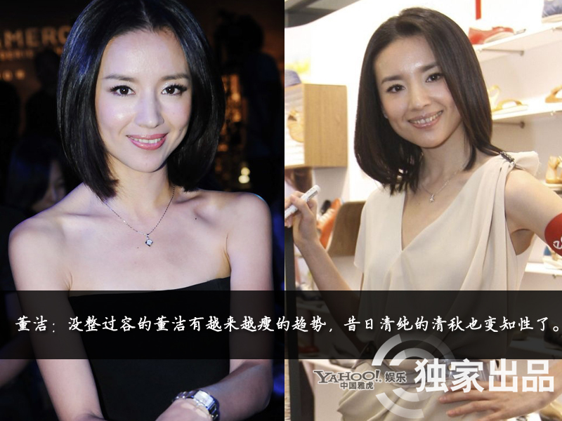 娛樂圈整容成風 娛樂圈整容成風