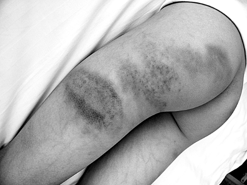 老師持掃帚打?qū)W生30分鐘 一個(gè)班20個(gè)同學(xué)被打過(guò) 老師持掃帚打?qū)W生30分鐘 一個(gè)班20個(gè)同學(xué)被打過(guò)