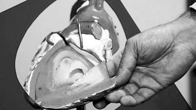 威廉斯領(lǐng)導(dǎo)的研究團(tuán)隊(duì)已經(jīng)利用人體脂肪干細(xì)胞，成功3D打印出心臟血管和心臟瓣膜，待一顆心臟的所有部件打