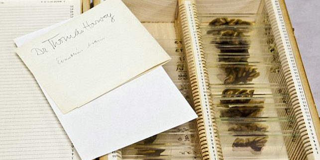 愛因斯坦大腦切片 愛因斯坦大腦切片