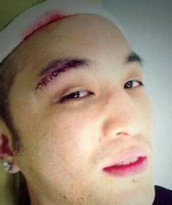 潘瑋柏受傷 潘瑋柏受傷