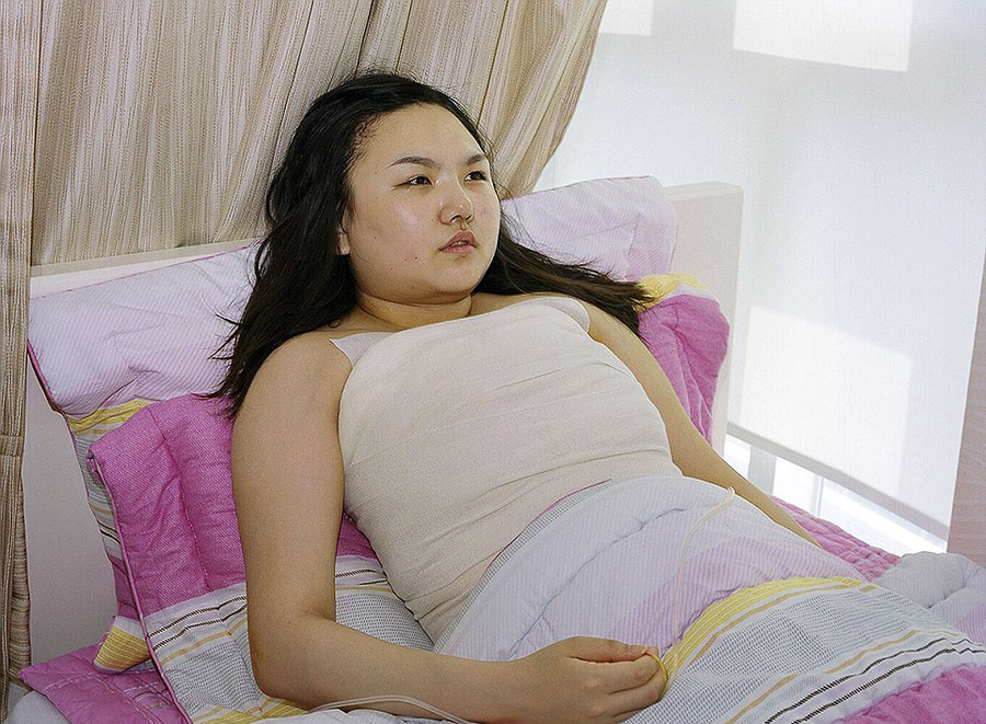 韓攝影師鏡頭記錄患者整容術(shù)后的生活 韓攝影師鏡頭記錄患者整容術(shù)后的生活