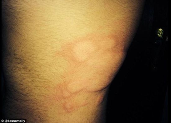 IS被指在敘利亞使用化學(xué)武器 有居民失明起水泡 IS被指在敘利亞使用化學(xué)武器 有居民失明起水泡