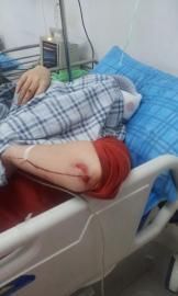 砸窗當(dāng)事人胡女士在醫(yī)院接受治療。