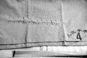 山東女童體內(nèi)12根針成功取出 專(zhuān)家主刀3個(gè)半小時(shí)