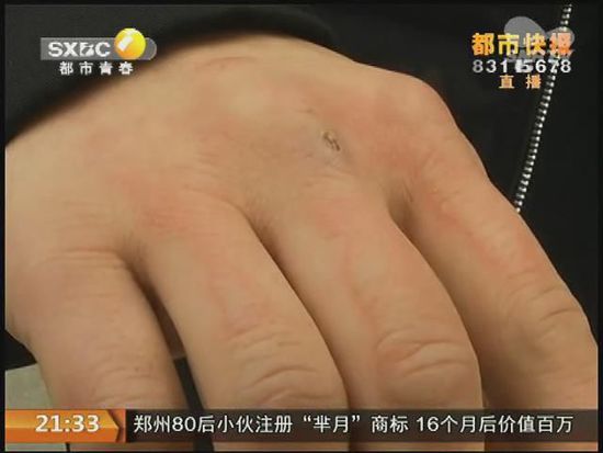 說到這足療拔罐，估計(jì)大伙都不陌生，但是想起4號(hào)晚上的拔罐的經(jīng)歷，呂先生現(xiàn)在想起來，還心有余悸。