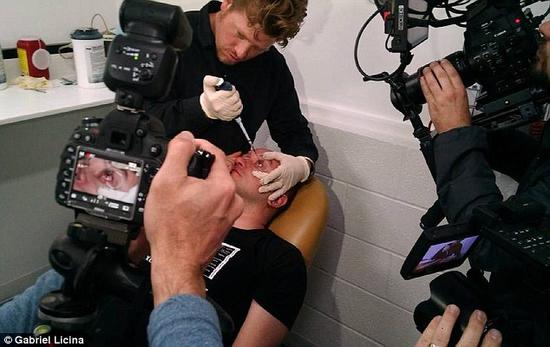 該實(shí)驗(yàn)是由加州一支名為“生物駭客”的實(shí)驗(yàn)團(tuán)隊(duì)開(kāi)展的。他們使用了一種名為二氫卟吩e6（Ce6）的物質(zhì)的溶液。Ce6常見(jiàn)于深海魚(yú)體內(nèi)，有光敏特性，通常用于癌癥治療研究中。研究團(tuán)隊(duì)將Ce6與胰島素和鹽水混合起來(lái)，得到一種溶液，可以在低光照條件下提高人類的視力。