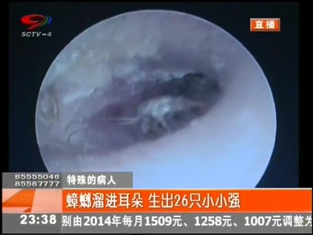 小強溜進(jìn)耳朵？生26只小小強