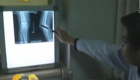 冷空氣來襲 如何預防老寒腿？