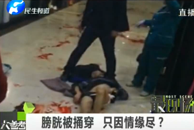 膀胱被捅穿 只因情緣盡？